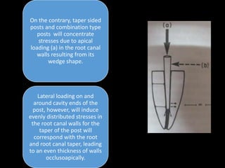 On the contrary, taper sided
posts and combination type
posts will concentrate
stresses due to apical
loading (a) in the root canal
walls resulting from its
wedge shape.
Lateral loading on and
around cavity ends of the
post, however, will induce
evenly distributed stresses in
the root canal walls for the
taper of the post will
correspond with the root
and root canal taper, leading
to an even thickness of walls
occlusoapically.
 
