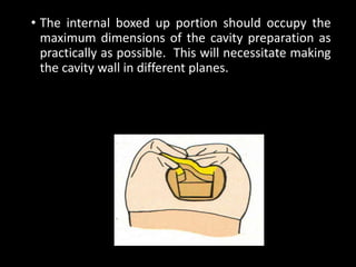 • The internal boxed up portion should occupy the
maximum dimensions of the cavity preparation as
practically as possible. This will necessitate making
the cavity wall in different planes.
 
