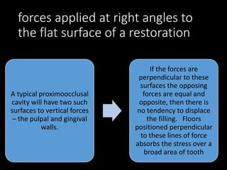 forces applied at right angles to
the flat surface of a restoration
A typical proximoocclusal
cavity will have two such
surfaces to vertical forces
– the pulpal and gingival
walls.
If the forces are
perpendicular to these
surfaces the opposing
forces are equal and
opposite, then there is
no tendency to displace
the filling. Floors
positioned perpendicular
to these lines of force
absorbs the stress over a
broad area of tooth
 