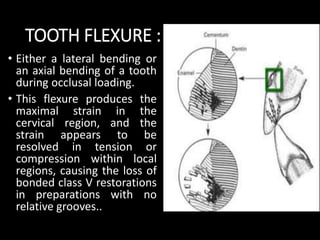 TOOTH FLEXURE :
• Either a lateral bending or
an axial bending of a tooth
during occlusal loading.
• This flexure produces the
maximal strain in the
cervical region, and the
strain appears to be
resolved in tension or
compression within local
regions, causing the loss of
bonded class V restorations
in preparations with no
relative grooves..
 