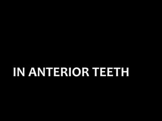 IN ANTERIOR TEETH
 