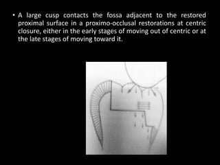 • A large cusp contacts the fossa adjacent to the restored
proximal surface in a proximo-occlusal restorations at centric
closure, either in the early stages of moving out of centric or at
the late stages of moving toward it.
 