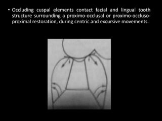 • Occluding cuspal elements contact facial and lingual tooth
structure surrounding a proximo-occlusal or proximo-occluso-
proximal restoration, during centric and excursive movements.
 