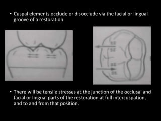 • Cuspal elements occlude or disocclude via the facial or lingual
groove of a restoration.
• There will be tensile stresses at the junction of the occlusal and
facial or lingual parts of the restoration at full intercuspation,
and to and from that position.
 
