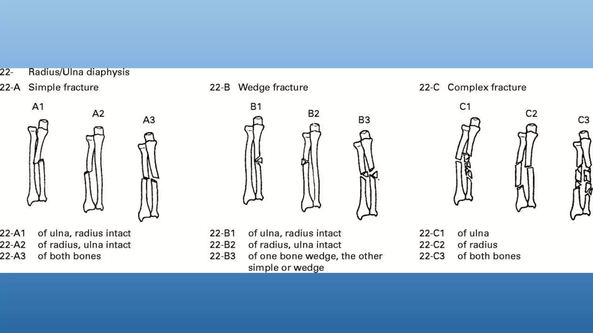 Forearm fractures | PPTX