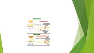 FOREARM_FRACTURES[1].pptx and management