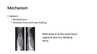 Forearm Fractures of Adults | PPTX