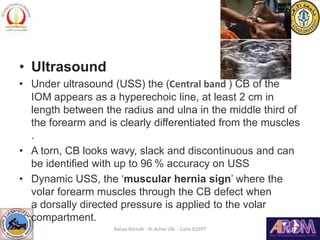 Uss Dynamic Forearm instability | PPT