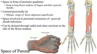 Space of Parona
• Space in front of pronator quadratus
• Deep to long flexor tendons of fingers and their synovial
sheaths
• Limited proximally by
• Oblique origin of flexor digitorum superficialis
• Space involved in proximal extensions of synovial
sheath infections
• Can be drained through radial and ulnar incisions to the
side of the flexor tendons
 