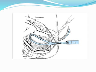 Cold Foreceps FORECEPS & VACUUM (2)h.pptx