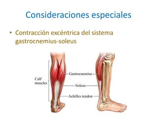 Consideraciones especiales
• Contracción excéntrica del sistema
gastrocnemius-soleus
 
