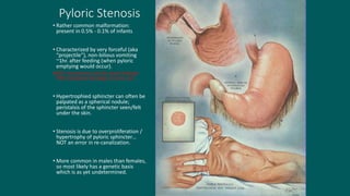 Pyloric Stenosis
• Rather common malformation:
present in 0.5% - 0.1% of infants
• Characterized by very forceful (aka
“projectile”), non-bilious vomiting
~1hr. after feeding (when pyloric
emptying would occur).
NOTE: the presence of bile would indicate
POST-duodenal blockage of some sort.
• Hypertrophied sphincter can often be
palpated as a spherical nodule;
peristalsis of the sphincter seen/felt
under the skin.
• Stenosis is due to overproliferation /
hypertrophy of pyloric sphincter…
NOT an error in re-canalization.
• More common in males than females,
so most likely has a genetic basis
which is as yet undetermined.
 