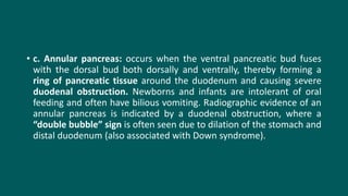 • c. Annular pancreas: occurs when the ventral pancreatic bud fuses
with the dorsal bud both dorsally and ventrally, thereby forming a
ring of pancreatic tissue around the duodenum and causing severe
duodenal obstruction. Newborns and infants are intolerant of oral
feeding and often have bilious vomiting. Radiographic evidence of an
annular pancreas is indicated by a duodenal obstruction, where a
“double bubble” sign is often seen due to dilation of the stomach and
distal duodenum (also associated with Down syndrome).
 