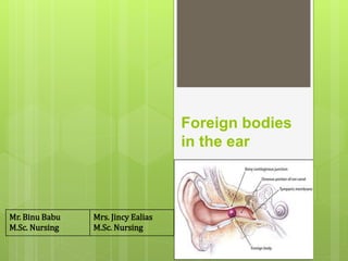 Foreign bodies
in the ear
Mr. Binu Babu
M.Sc. Nursing
Mrs. Jincy Ealias
M.Sc. Nursing
 