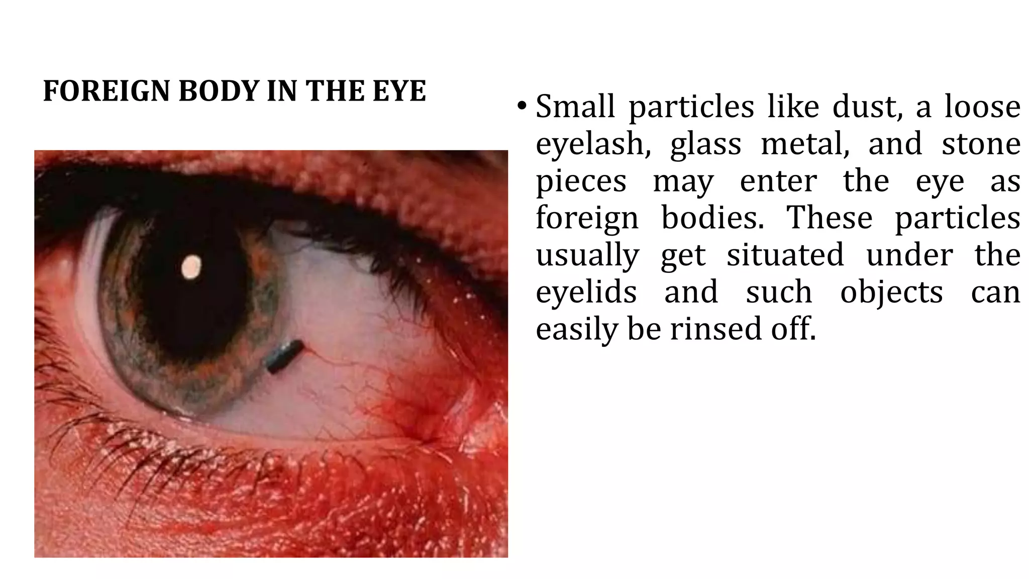 FOREIGN BODY IN THE SKIN.pptx