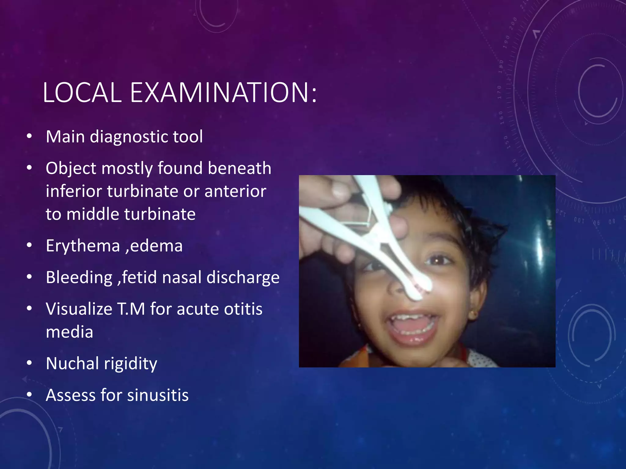 Foreign body nose | PPTX