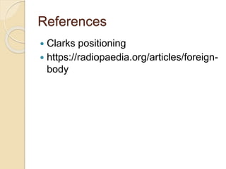 foreign body radiography.pptx
