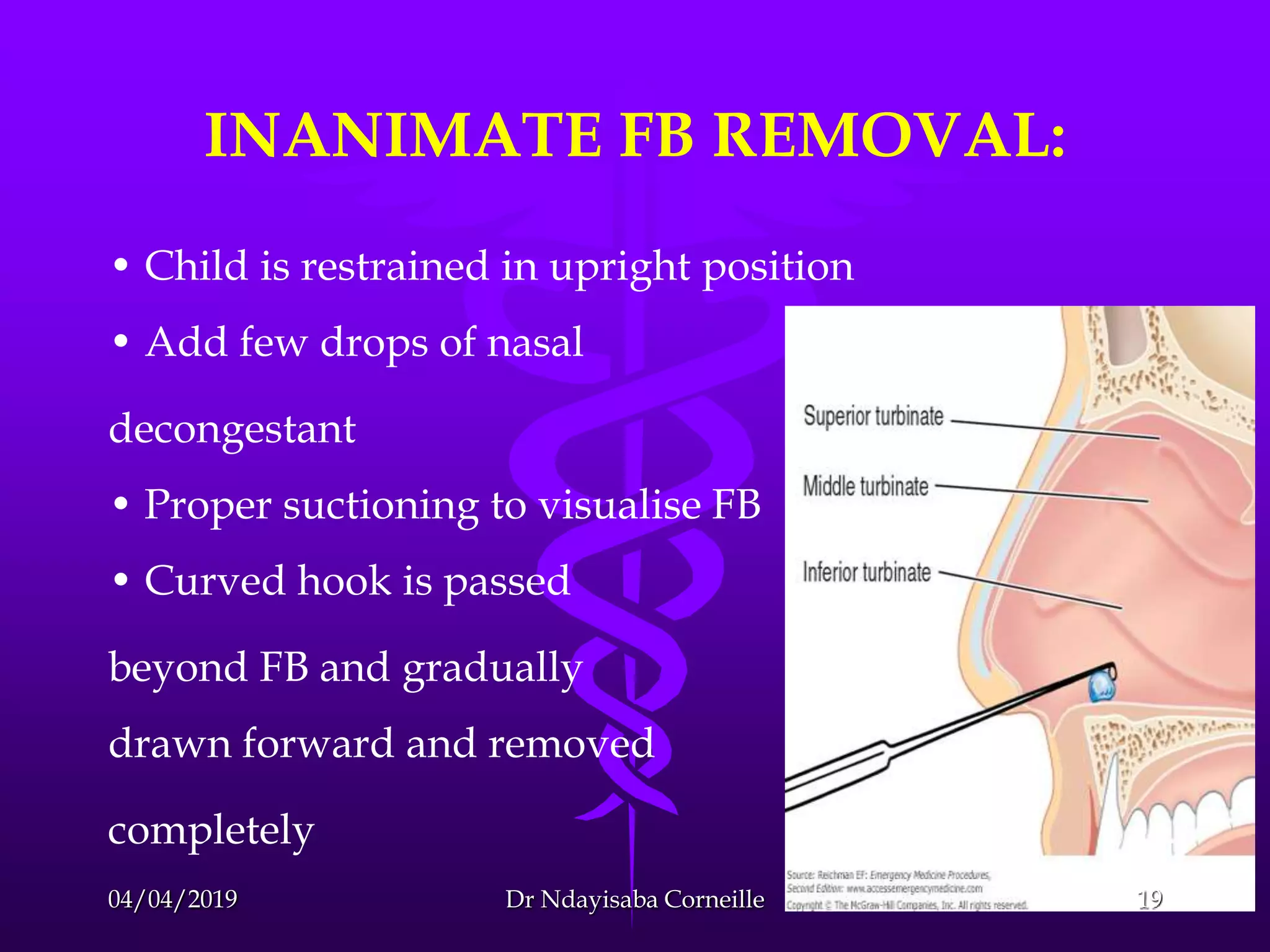 forein-body-in-the-ear-and-the-nose-management-pptx