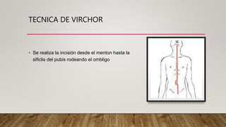 TECNICA DE VIRCHOR
• Se realiza la incisión desde el menton hasta la
sificlis del pubis rodeando el ombligo
 