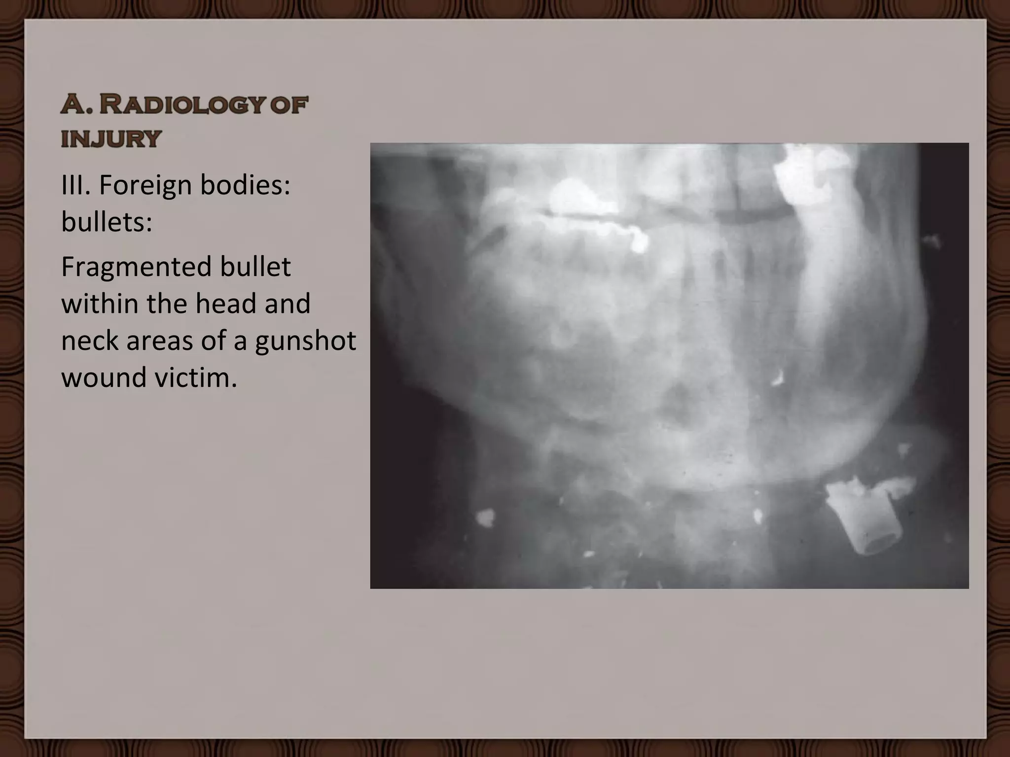 Forensic Radiology Practical Under | PPT