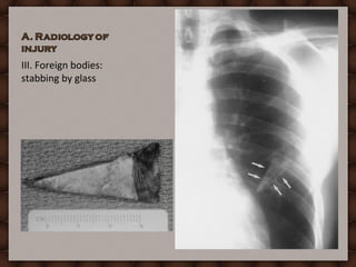 Glass Radiograph Forensic Radiology Practical Under | PPT