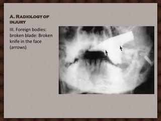 Forensic Radiology Practical Under | PPT