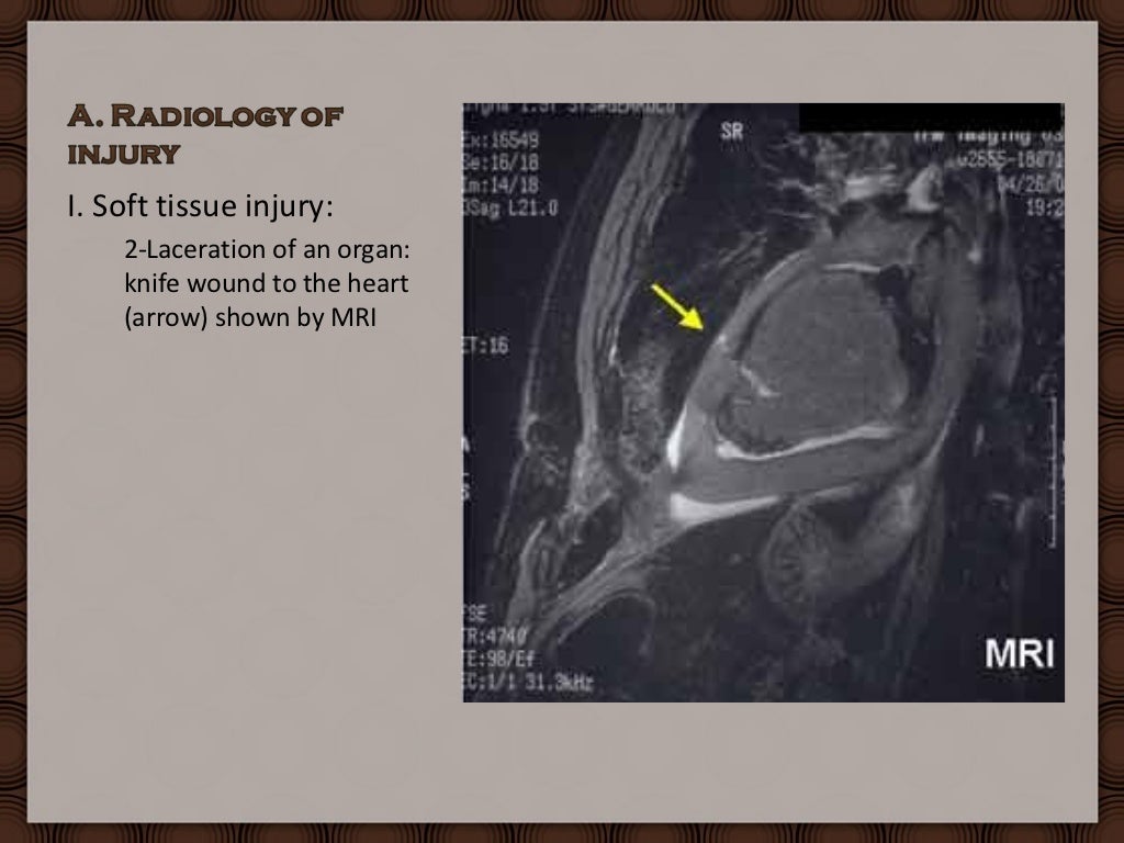 Forensic Radiology Practical Under
