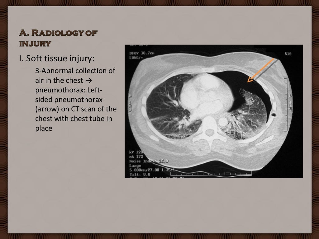 Forensic Radiology Practical Under
