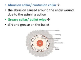 forensic-ballistics-pptx