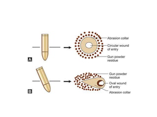 Forensic Ballistics.pptx