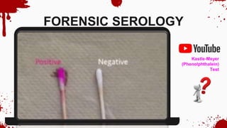 FORENSIC SEROLOGY
Kastle-Meyer
(Phenolphthalein)
Test
 