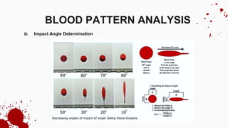 III. Impact Angle Determination
BLOOD PATTERN ANALYSIS
 