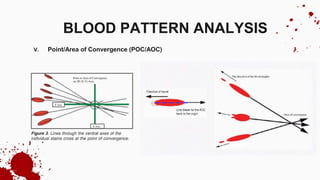 V. Point/Area of Convergence (POC/AOC)
BLOOD PATTERN ANALYSIS
 