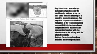 Top: this extract from a larger
survey clearly delineates the
position of a training grave cut
into chalk which is showing as a
negative magnetic anomaly. The
negative response results from a
reduction in the volume magnetic
susceptibility in the topsoil over
the grave caused by the lack of
compaction together with the
dilution due to the mixing with the
chalk fragments.
Bottom: Forensic archaeology
students excavating the grave.
 
