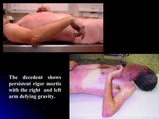 Forensic medical theory of death | PPT