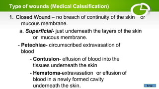 Type of wounds (Medical Calssification)
1. Closed Wound – no breach of continuity of the skin or
mucous membrane.
a. Superficial- just underneath the layers of the skin
or mucous membrane.
- Petechiae- circumscribed extravasation of
blood
- Contusion- effusion of blood into the
tissues underneath the skin
- Hematoma-extravasation or effusion of
blood in a newly formed cavity
underneath the skin. knip
 