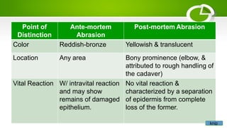 Point of
Distinction
Ante-mortem
Abrasion
Post-mortem Abrasion
Color Reddish-bronze Yellowish & translucent
Location Any area Bony prominence (elbow, &
attributed to rough handling of
the cadaver)
Vital Reaction W/ intravital reaction
and may show
remains of damaged
epithelium.
No vital reaction &
characterized by a separation
of epidermis from complete
loss of the former.
knip
 
