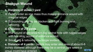 Shotgun Wound
c. Distance of about 1 yard
 Pellets enter as one mass thus making entrance wound with
irregular edges.
 Surrounding skin ay be blacken with light burning and
tattooing.
d. Distance of 2-3 yards
 The wound of entrance has big central hole with rugged edges
with few stray wound of entrance wound.
 Smudging & tattooing - no longer evident.
e. Distance of 4 yards - pellets may enter skin area of about 6-8
inches diameter although there may be a central care where a
group might have entered. knip
 