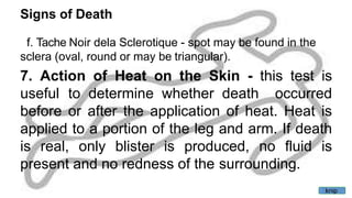 Signs of Death
f. Tache Noir dela Sclerotique - spot may be found in the
sclera (oval, round or may be triangular).
7. Action of Heat on the Skin - this test is
useful to determine whether death occurred
before or after the application of heat. Heat is
applied to a portion of the leg and arm. If death
is real, only blister is produced, no fluid is
present and no redness of the surrounding.
knip
 