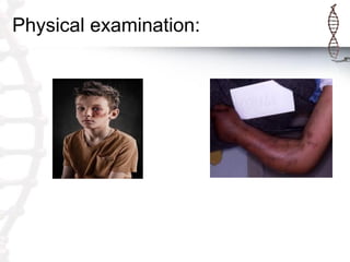 Physical examination:
 