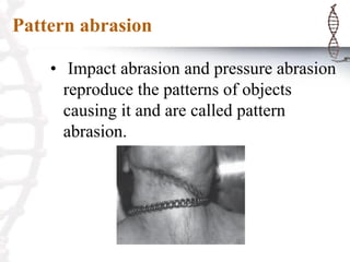 Pattern abrasion
• Impact abrasion and pressure abrasion
reproduce the patterns of objects
causing it and are called pattern
abrasion.
 