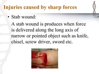 Injuries caused by sharp forces
• Stab wound:
A stab wound is produces when force
is delivered along the long axis of
narrow or pointed object such as knife,
chisel, screw driver, sword etc.
 