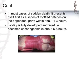 Cont.
• In most cases of sudden death, it presents
itself first as a series of mottled patches on
the dependent parts within about 1-3 hours.
• Lividity is fully developed and fixed i.e.
becomes unchangeable in about 6-8 hours.
 