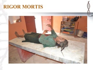 RIGOR MORTIS
 