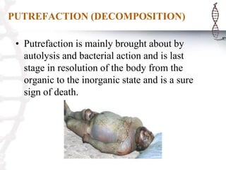 PUTREFACTION (DECOMPOSITION)
• Putrefaction is mainly brought about by
autolysis and bacterial action and is last
stage in resolution of the body from the
organic to the inorganic state and is a sure
sign of death.
 