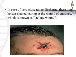 • In case of very close range discharge, there may
be star shaped tearing at the wound of entrance,
which is known as "stellate wound".
 