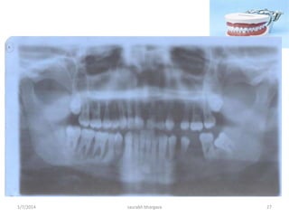 Identify the most probable animal just
by looking at the dentition
10/6/2016 27saurabh bhargava
 