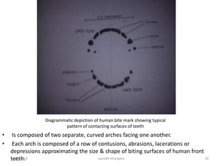 DENTAL PROFILING
• Dental profiling includes extracting a triad of
information-the decedent’s ethnic origin, gender
and age.
• The information from this process will enable a
more focused search for ante-mortem records .
• There are a total of three steps in a dental
profiling-
10/6/2016 50saurabh bhargava
 