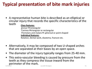 Identifying Ethnic Origin From Teeth
• Anthropologists have divided race into following broad groups-
(i) Caucasoid
(ii) Negroid
(iii) Mongoloid
(iv) Eskimos
(v) American Indians
• Dental features used to describe population differences are broadly
categorized as metric (tooth size) and non metric (tooth shape).
• Metric features are based on measurements and non metric in
terms of presence or absence of a particular feature , e.g: whether
carabelli’s cusp is present or absent.
10/6/2016 51saurabh bhargava
 