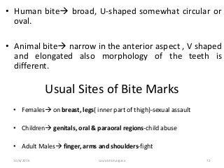 10/6/2016 saurabh bhargava 72
• Human bite broad, U-shaped somewhat circular or
oval.
• Animal bite narrow in the anterior aspect , V shaped
and elongated also morphology of the teeth is
different.
Usual Sites of Bite Marks
• Females on breast, legs( inner part of thigh)-sexual assault
• Children genitals, oral & paraoral regions-child abuse
• Adult Males finger, arms and shoulders-fight
 